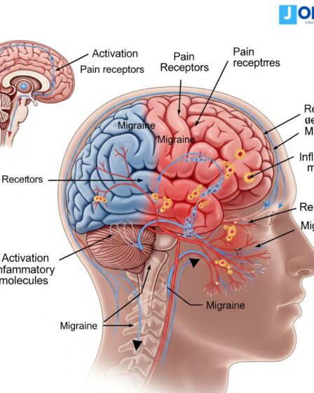 Migraine Maroc : فهم مرض والعلاجات المرتبطة بالصداع النصفي